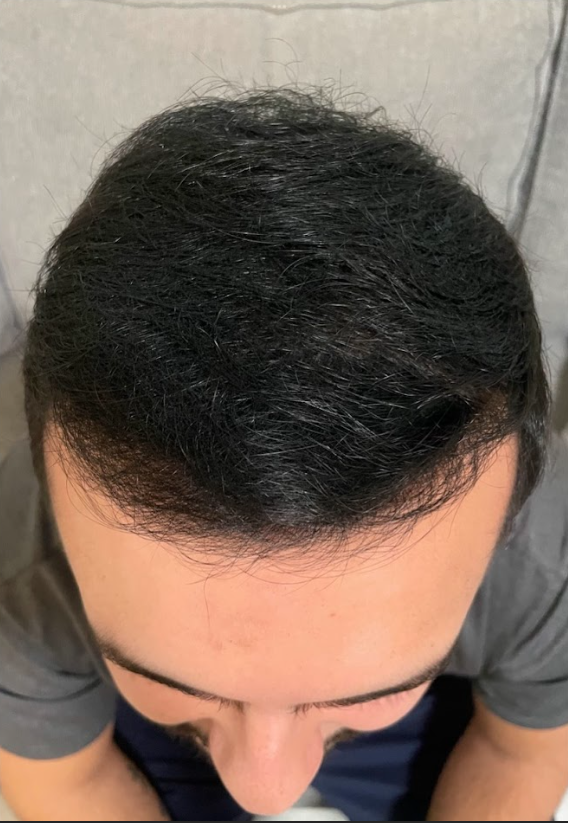 HAIR SPECIALIST